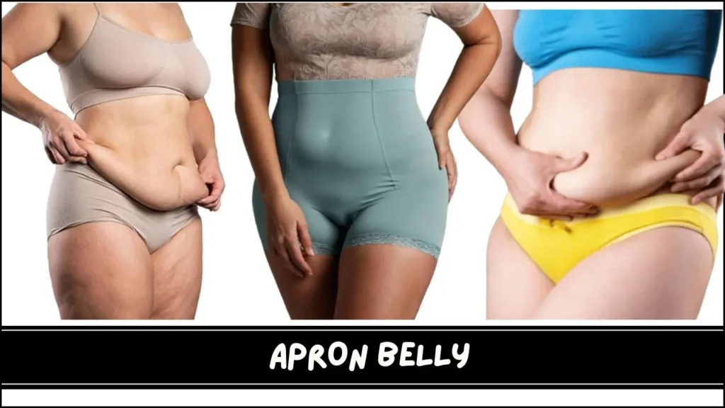 apron-belly