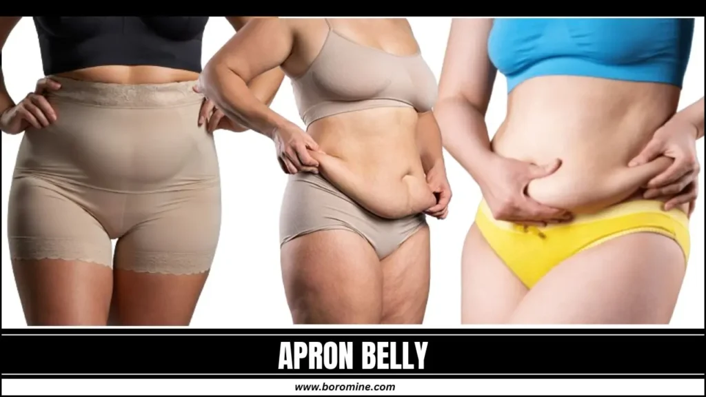 Apron-Belly