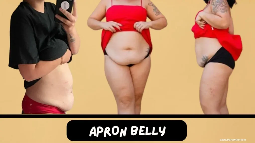 Apron-Belly