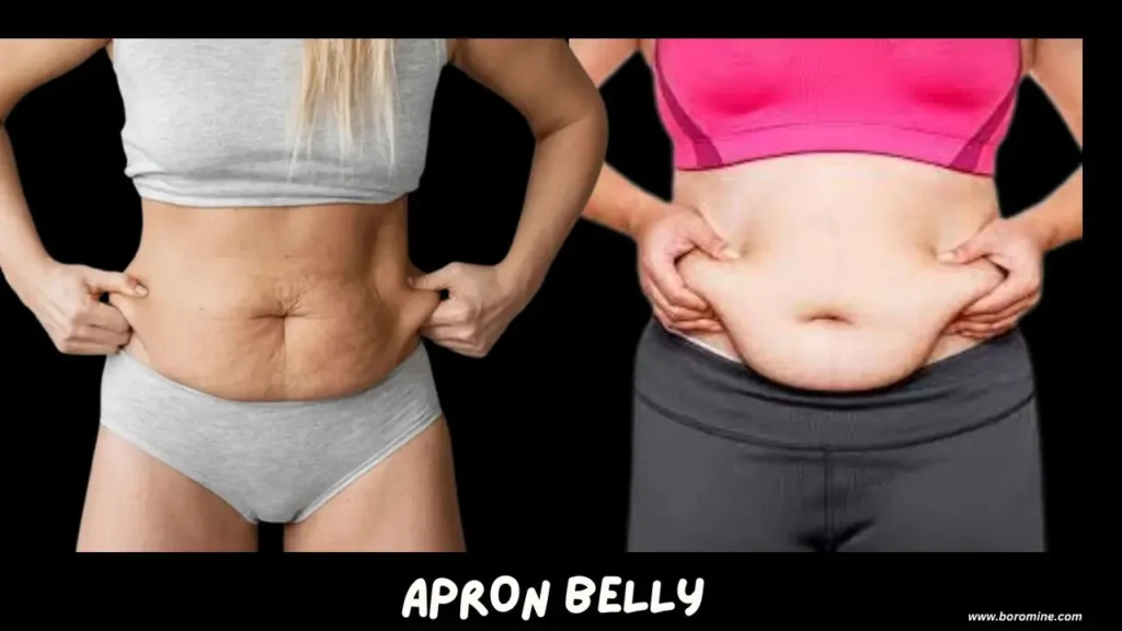 Apron-Belly