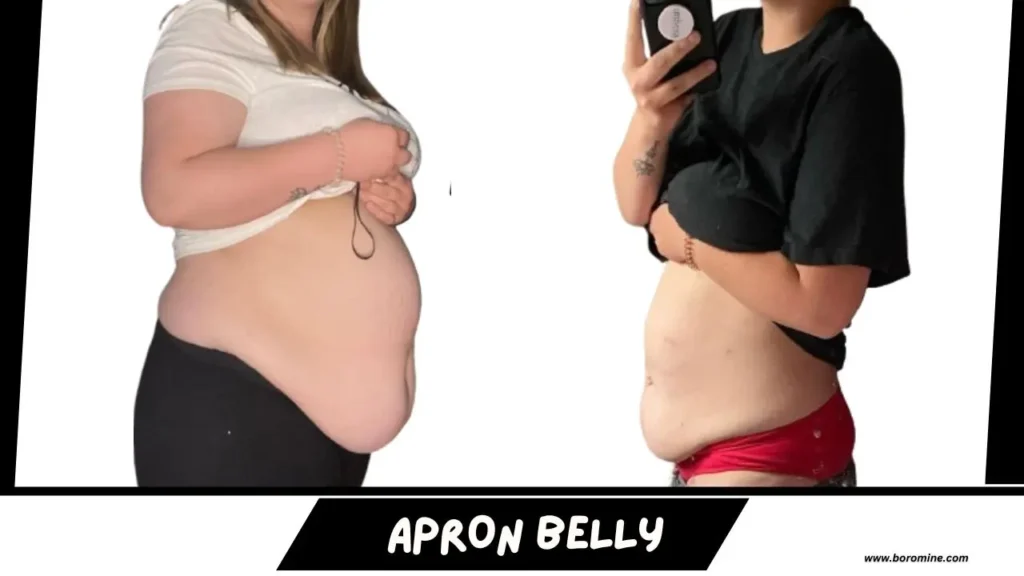 Apron-Belly