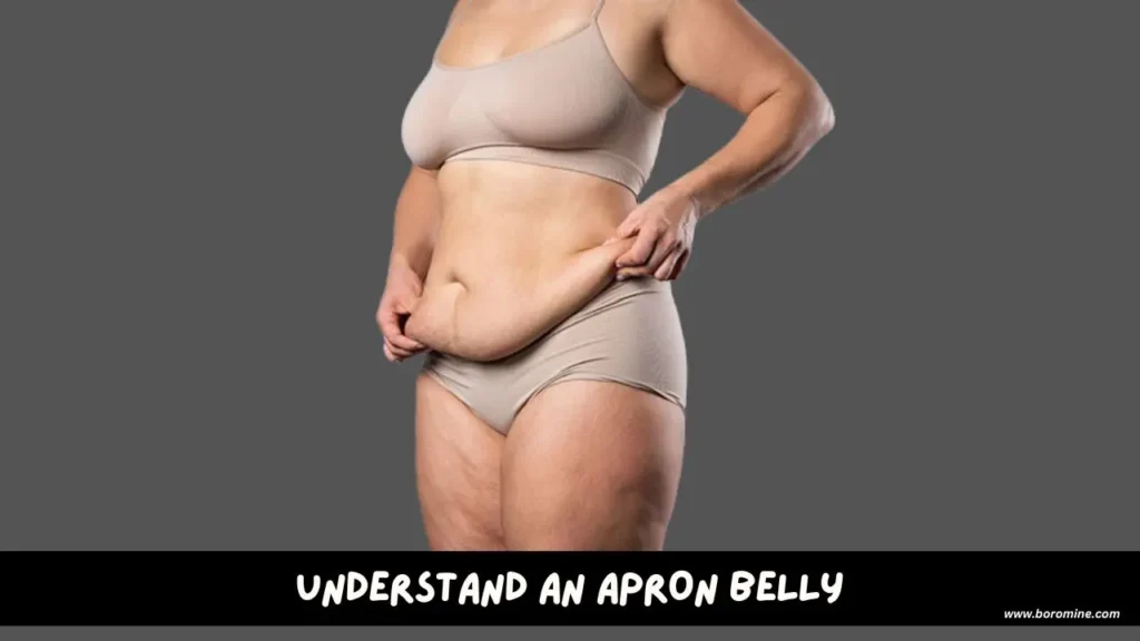 Understanding-Apron-belly